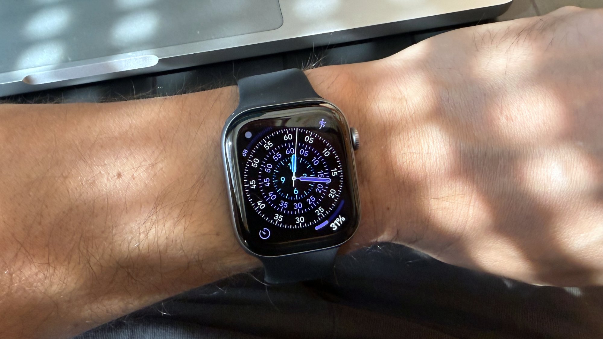 Seri Apple Watch 11